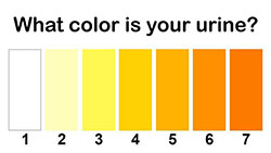 ¡Esto es lo que dice el color de tu orina sobre tu salud!: 