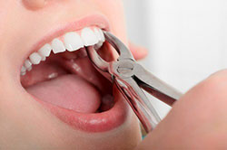 Reemplazo de dientes Christchurch: 
